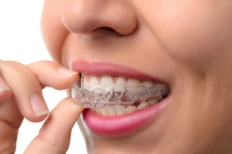 The Evolution and Importance of Dental Braces...!!!